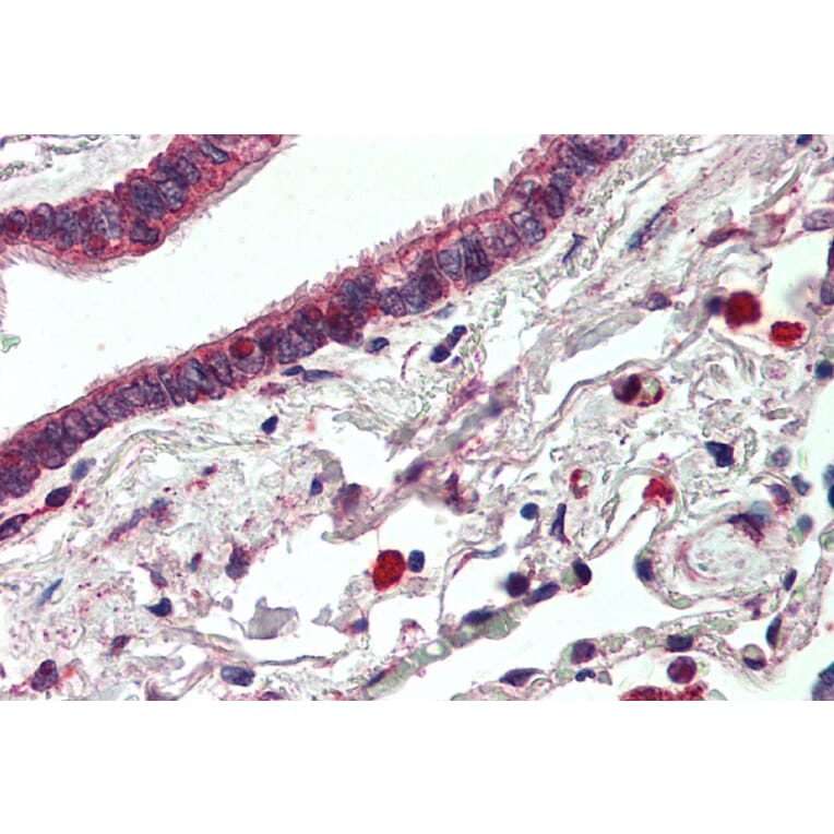 Immunohistochemistry - Anti-ErbB3/HER3 Antibody (A83248) - Antibodies.com