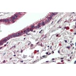 Immunohistochemistry - Anti-ErbB3/HER3 Antibody (A83248) - Antibodies.com