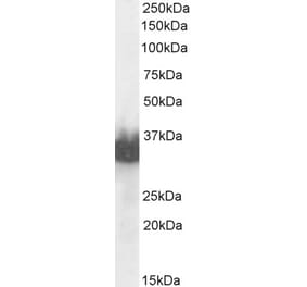 Western Blot - Anti-Prostate Specific Antigen Antibody (A83249) - Antibodies.com