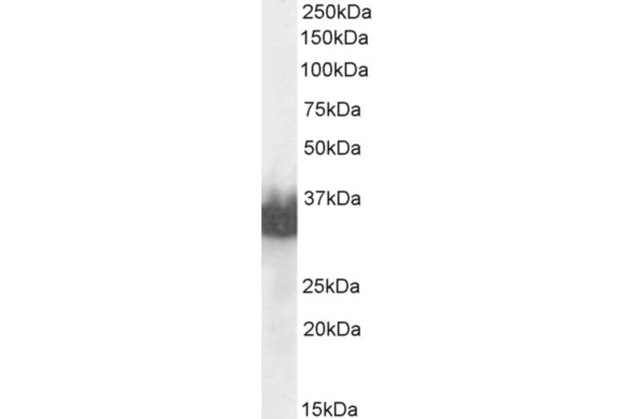 Western Blot - Anti-Prostate Specific Antigen Antibody (A83249) - Antibodies.com
