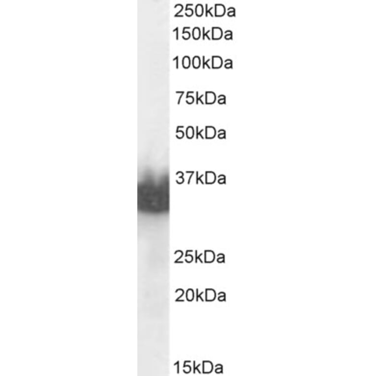Western Blot - Anti-Prostate Specific Antigen Antibody (A83249) - Antibodies.com