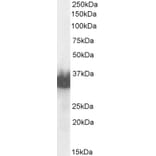 Western Blot - Anti-Prostate Specific Antigen Antibody (A83249) - Antibodies.com