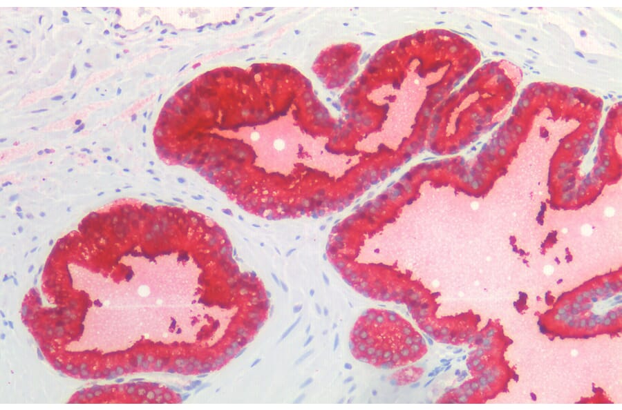 Immunohistochemistry - Anti-Prostate Specific Antigen Antibody (A83249) - Antibodies.com