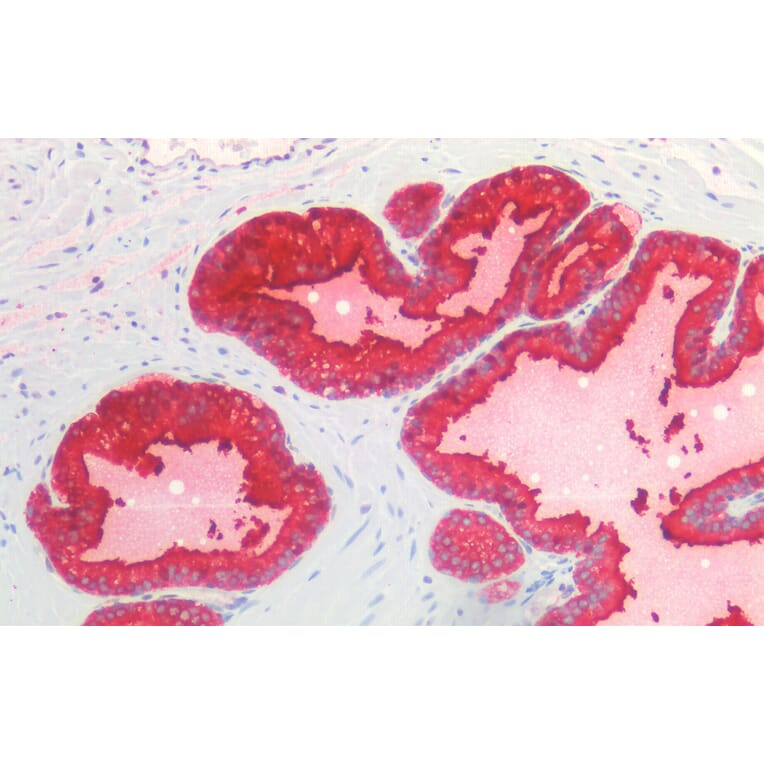 Immunohistochemistry - Anti-Prostate Specific Antigen Antibody (A83249) - Antibodies.com