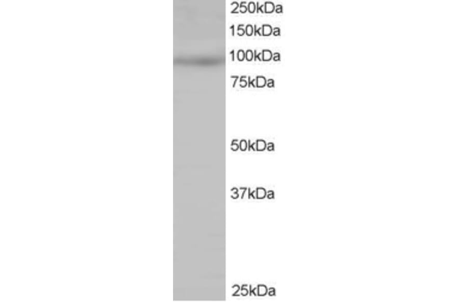 Western Blot - Anti-MAP4K1/HPK1 Antibody (A83250) - Antibodies.com