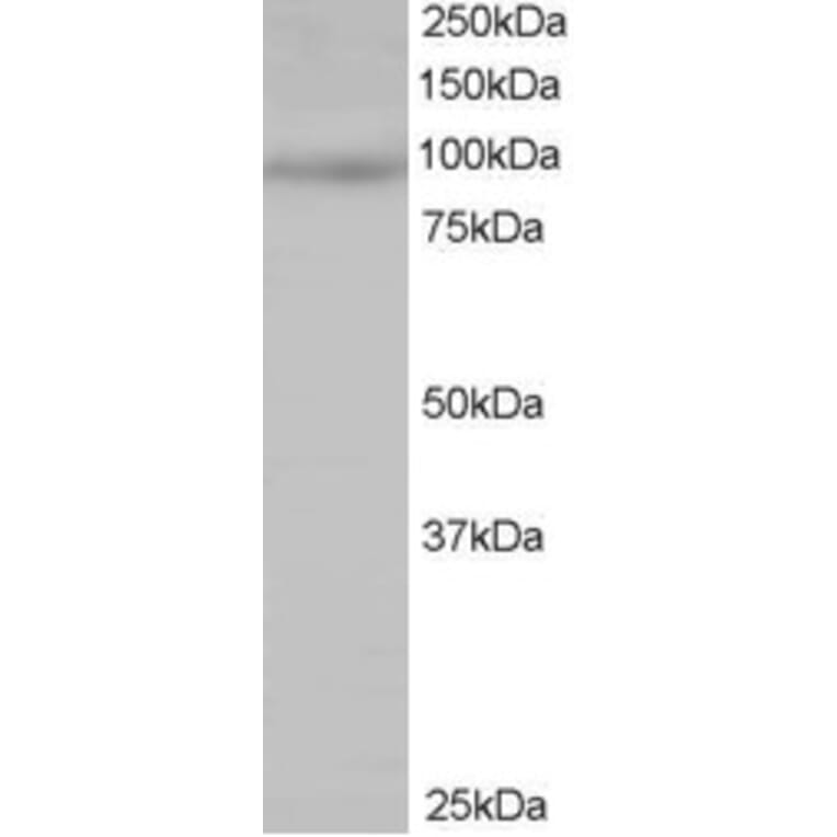 Western Blot - Anti-MAP4K1/HPK1 Antibody (A83250) - Antibodies.com