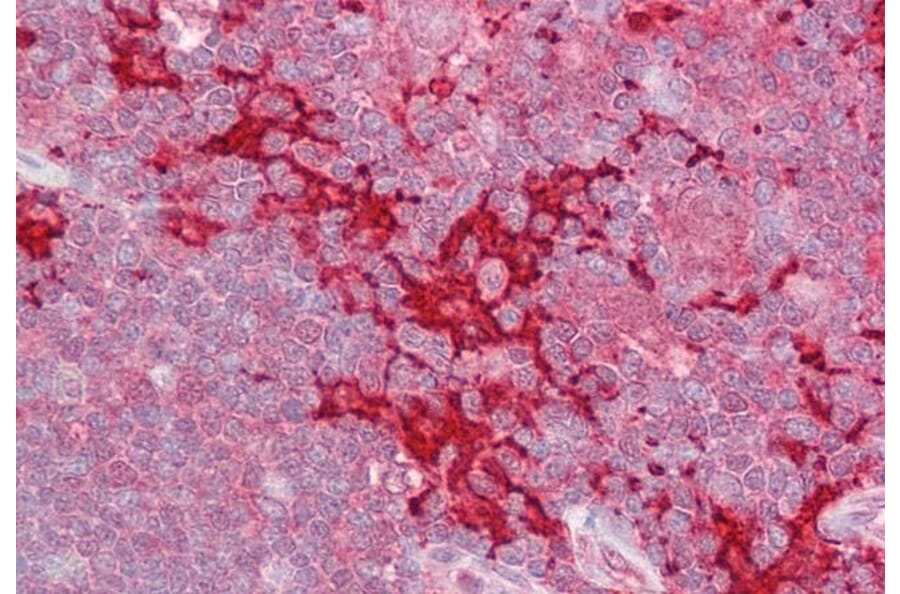 Immunohistochemistry - Anti-MAP4K1/HPK1 Antibody (A83250) - Antibodies.com