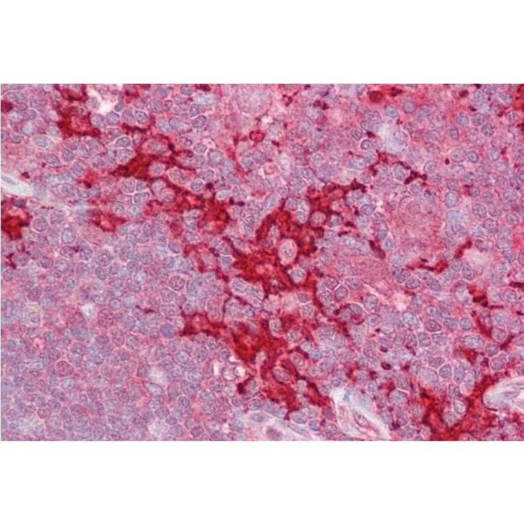 Immunohistochemistry - Anti-MAP4K1/HPK1 Antibody (A83250) - Antibodies.com