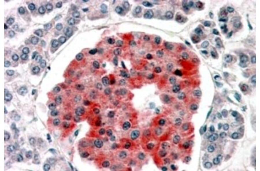 Immunohistochemistry - Anti-Kir6.2/BIR Antibody (A83251) - Antibodies.com