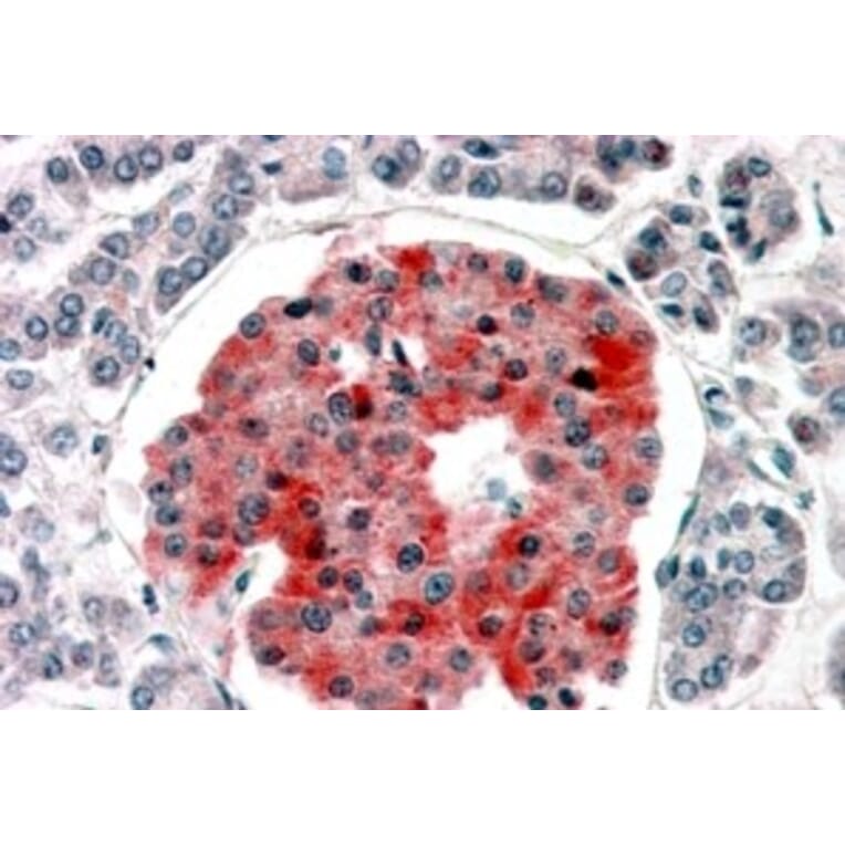 Immunohistochemistry - Anti-Kir6.2/BIR Antibody (A83251) - Antibodies.com