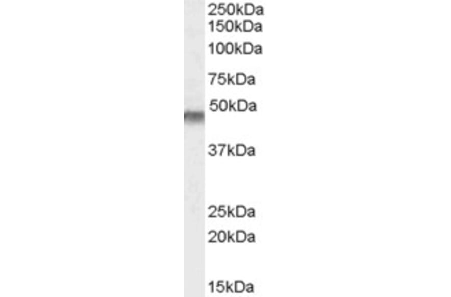 Western Blot - Anti-Kir6.2/BIR Antibody (A83251) - Antibodies.com