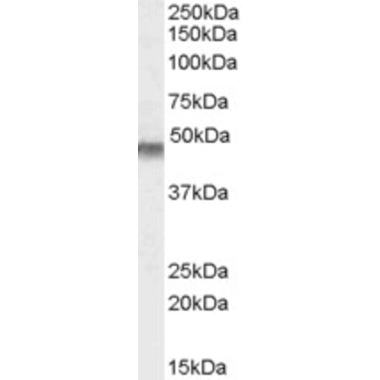 Western Blot - Anti-Kir6.2/BIR Antibody (A83251) - Antibodies.com