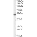 Western Blot - Anti-Kir6.2/BIR Antibody (A83251) - Antibodies.com