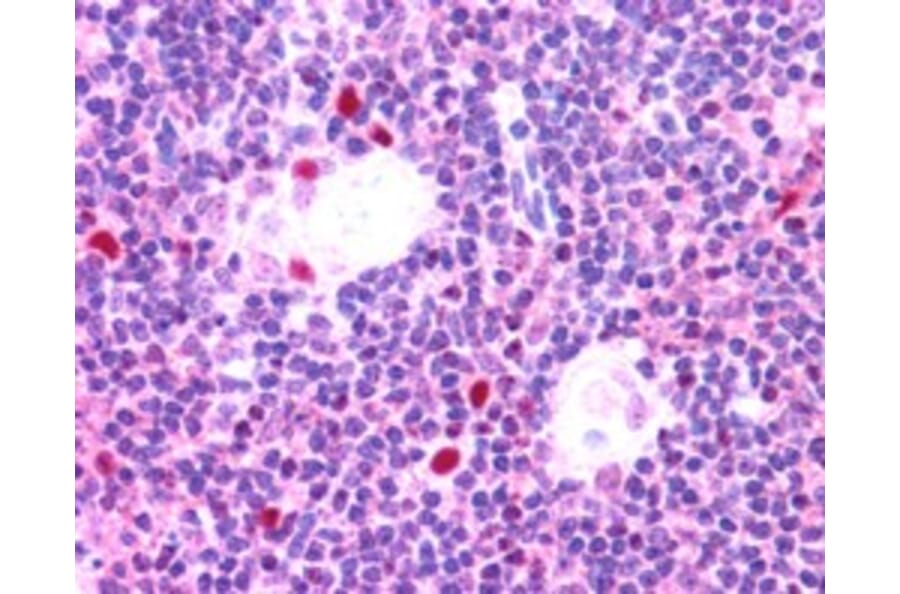 Immunohistochemistry - Anti-AIRE Antibody (A83252) - Antibodies.com