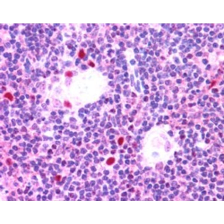 Immunohistochemistry - Anti-AIRE Antibody (A83252) - Antibodies.com