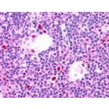 Immunohistochemistry - Anti-AIRE Antibody (A83252) - Antibodies.com