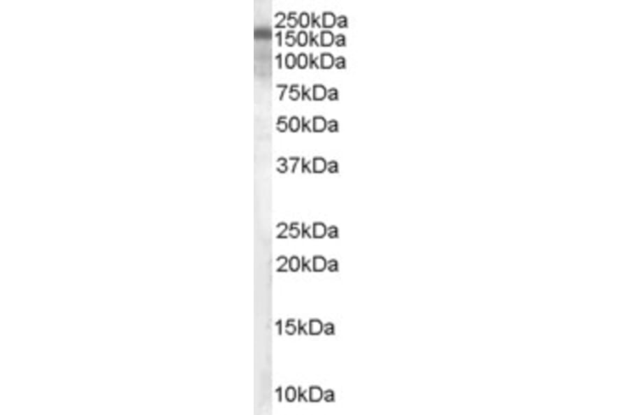 Western Blot - Anti-Hamartin Antibody (A83253) - Antibodies.com
