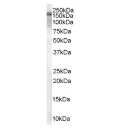 Western Blot - Anti-Hamartin Antibody (A83253) - Antibodies.com