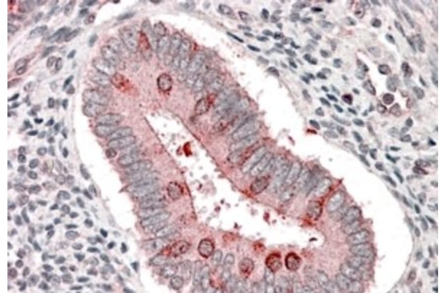 Immunohistochemistry - Anti-Hamartin Antibody (A83253) - Antibodies.com