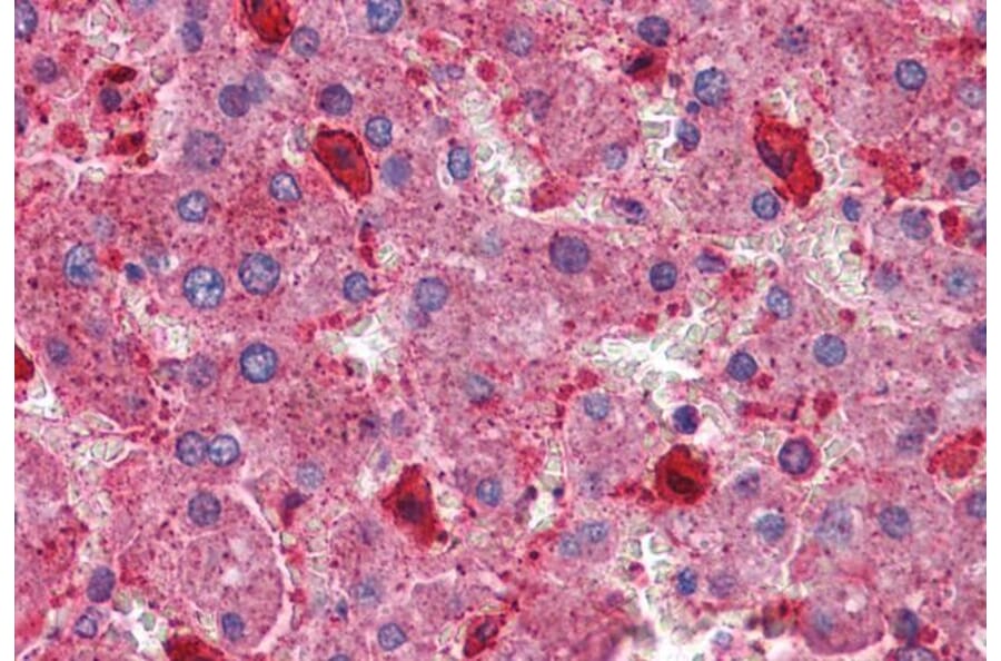 Immunohistochemistry - Anti-Hamartin Antibody (A83253) - Antibodies.com