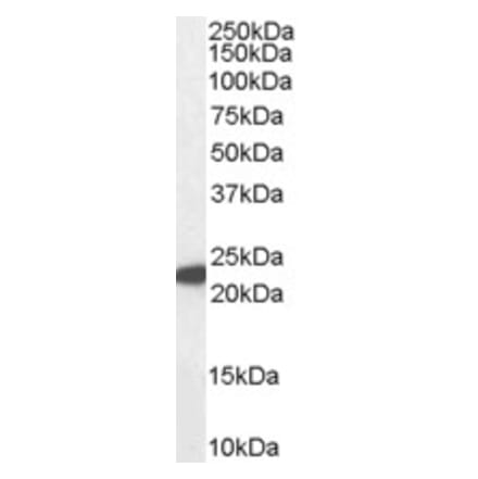 Western Blot - Anti-GPX1 Antibody (A83254) - Antibodies.com
