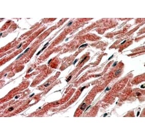 Immunohistochemistry - Anti-CPT1B Antibody (A83255) - Antibodies.com