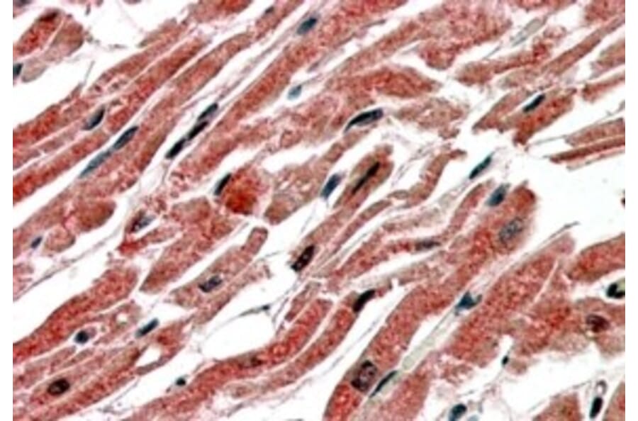 Immunohistochemistry - Anti-CPT1B Antibody (A83255) - Antibodies.com