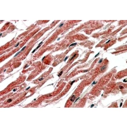 Immunohistochemistry - Anti-CPT1B Antibody (A83255) - Antibodies.com