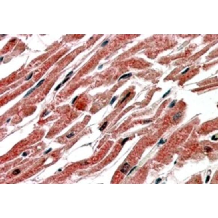 Immunohistochemistry - Anti-CPT1B Antibody (A83255) - Antibodies.com