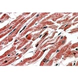 Immunohistochemistry - Anti-CPT1B Antibody (A83255) - Antibodies.com