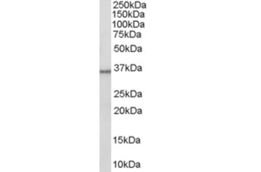 Western Blot - Anti-HSD11B1 Antibody (A83256) - Antibodies.com
