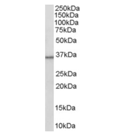 Western Blot - Anti-HSD11B1 Antibody (A83256) - Antibodies.com