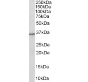 Western Blot - Anti-HSD11B1 Antibody (A83256) - Antibodies.com