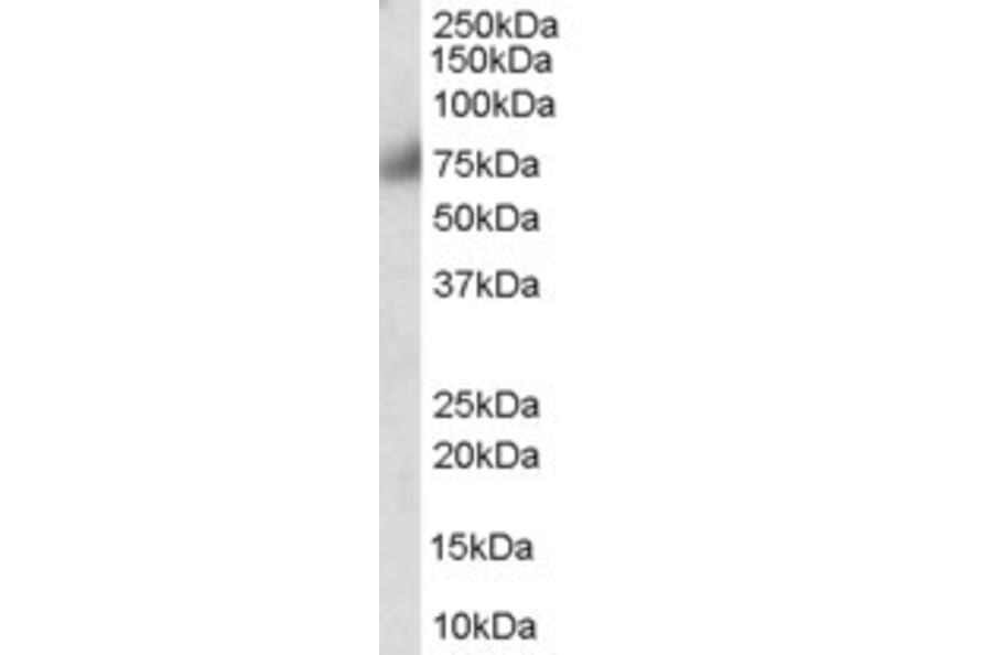 Western Blot - Anti-FGFR1 Antibody (A83257) - Antibodies.com