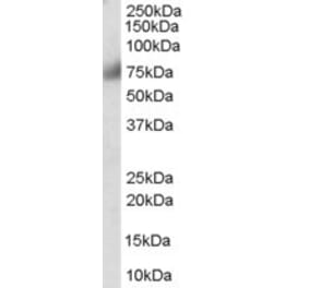 Western Blot - Anti-FGFR1 Antibody (A83257) - Antibodies.com