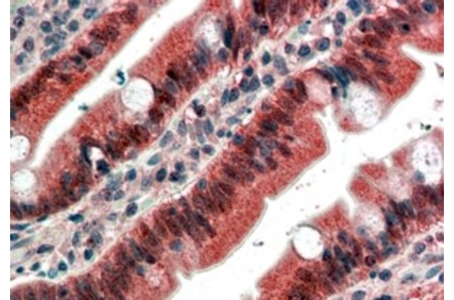 Immunohistochemistry - Anti-FGFR1 Antibody (A83257) - Antibodies.com