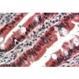 Immunohistochemistry - Anti-FGFR1 Antibody (A83257) - Antibodies.com