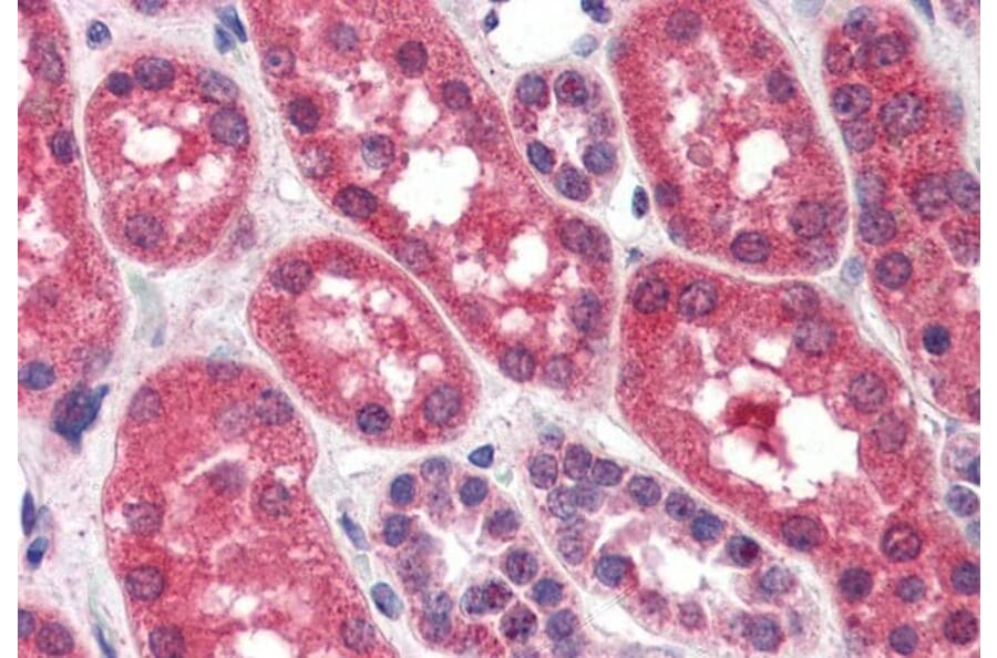 Immunohistochemistry - Anti-FGFR1 Antibody (A83257) - Antibodies.com