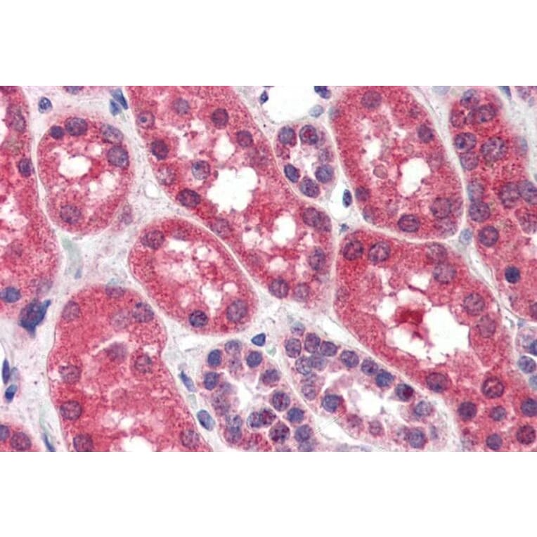 Immunohistochemistry - Anti-FGFR1 Antibody (A83257) - Antibodies.com