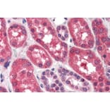 Immunohistochemistry - Anti-FGFR1 Antibody (A83257) - Antibodies.com