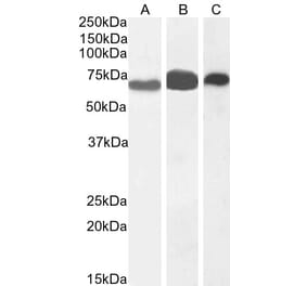 Western Blot - Anti-EHD2 Antibody (A83258) - Antibodies.com