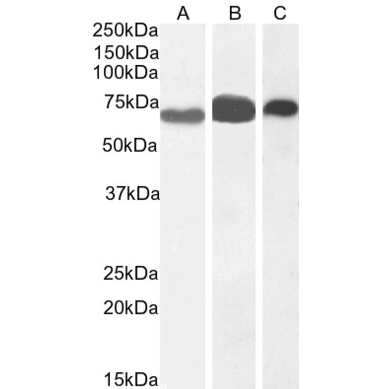 Western Blot - Anti-EHD2 Antibody (A83258) - Antibodies.com
