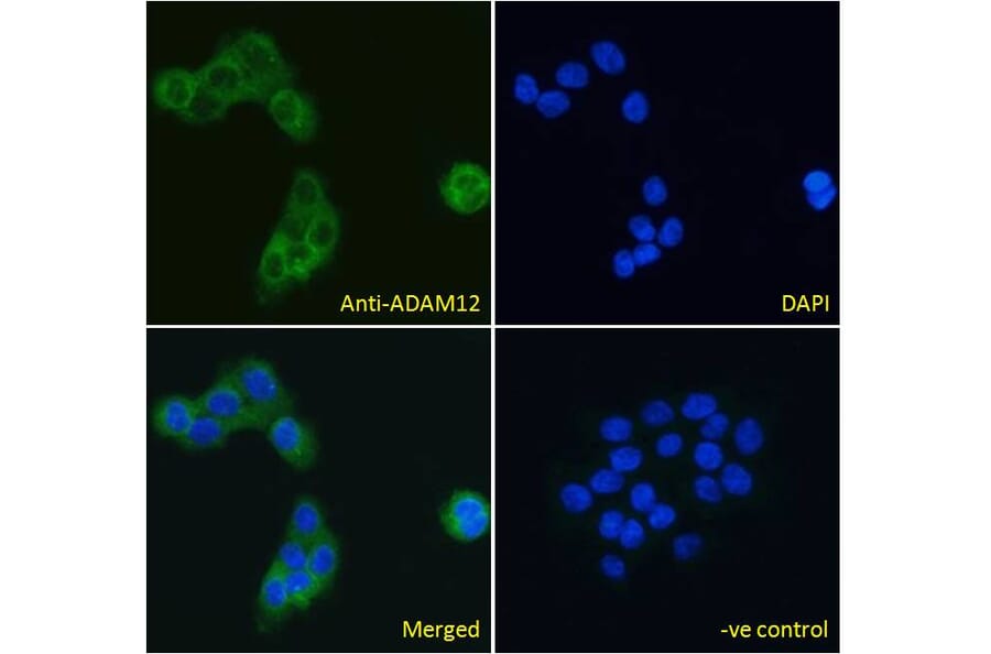 Immunofluorescence - Anti-ADAM12 Antibody (A83260) - Antibodies.com