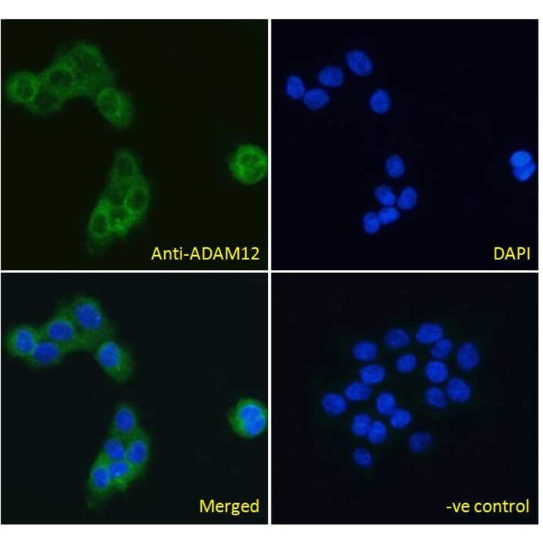 Immunofluorescence - Anti-ADAM12 Antibody (A83260) - Antibodies.com