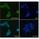 Immunofluorescence - Anti-ADAM12 Antibody (A83260) - Antibodies.com