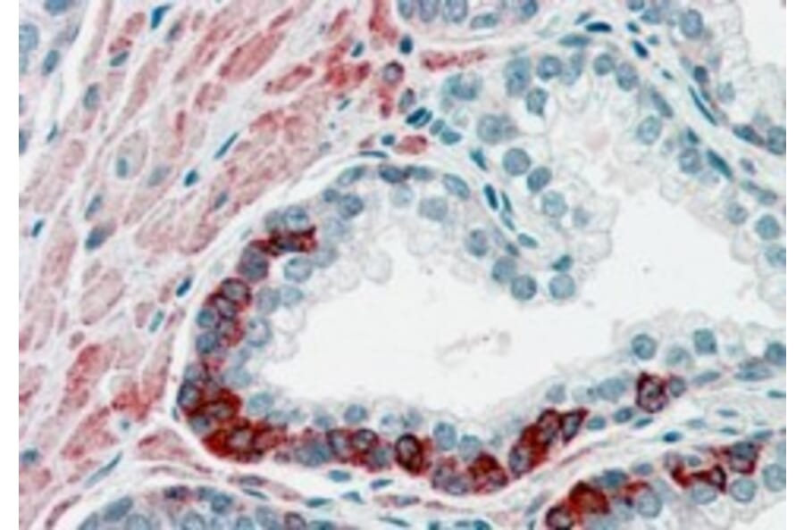 Immunohistochemistry - Anti-ADAM12 Antibody (A83260) - Antibodies.com
