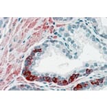 Immunohistochemistry - Anti-ADAM12 Antibody (A83260) - Antibodies.com