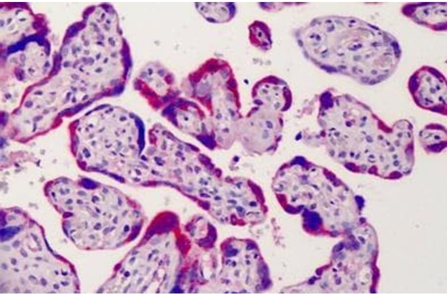 Immunohistochemistry - Anti-ADAM12 Antibody (A83260) - Antibodies.com