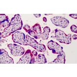 Immunohistochemistry - Anti-ADAM12 Antibody (A83260) - Antibodies.com