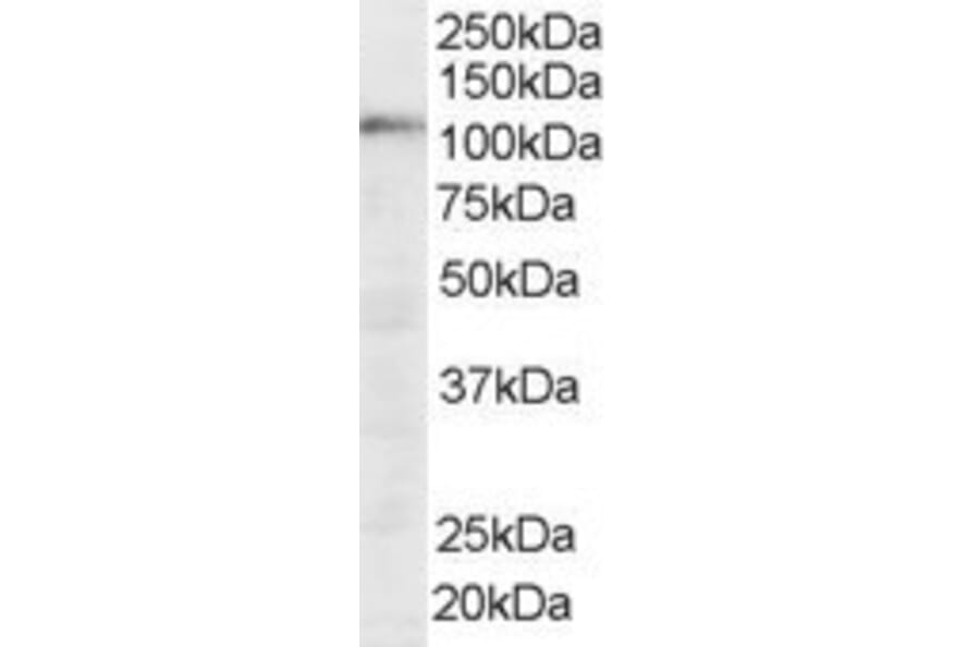 Western Blot - Anti-SART1 Antibody (A83261) - Antibodies.com